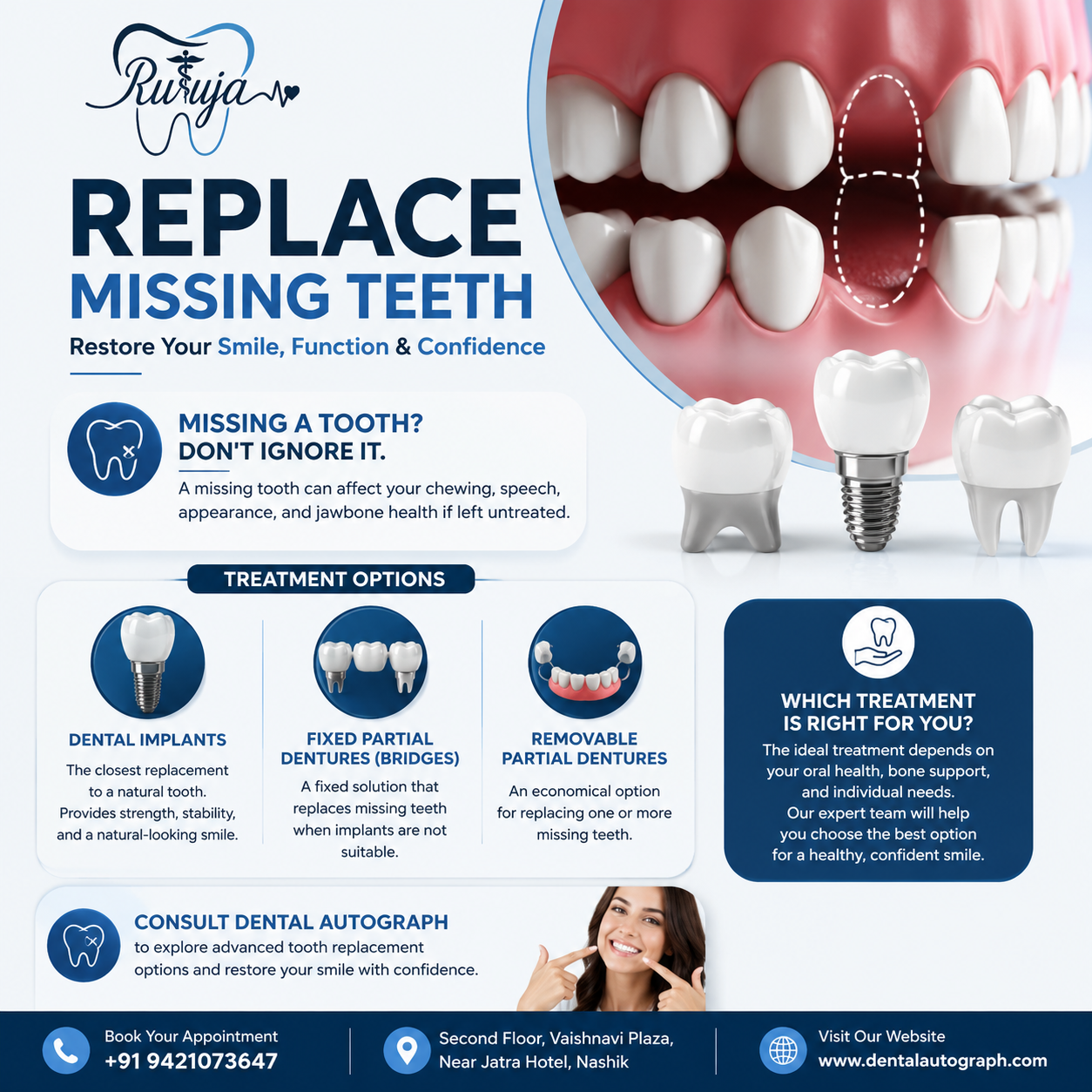 Replace Missing Teeth: Restore Your Smile, Function & Confidence