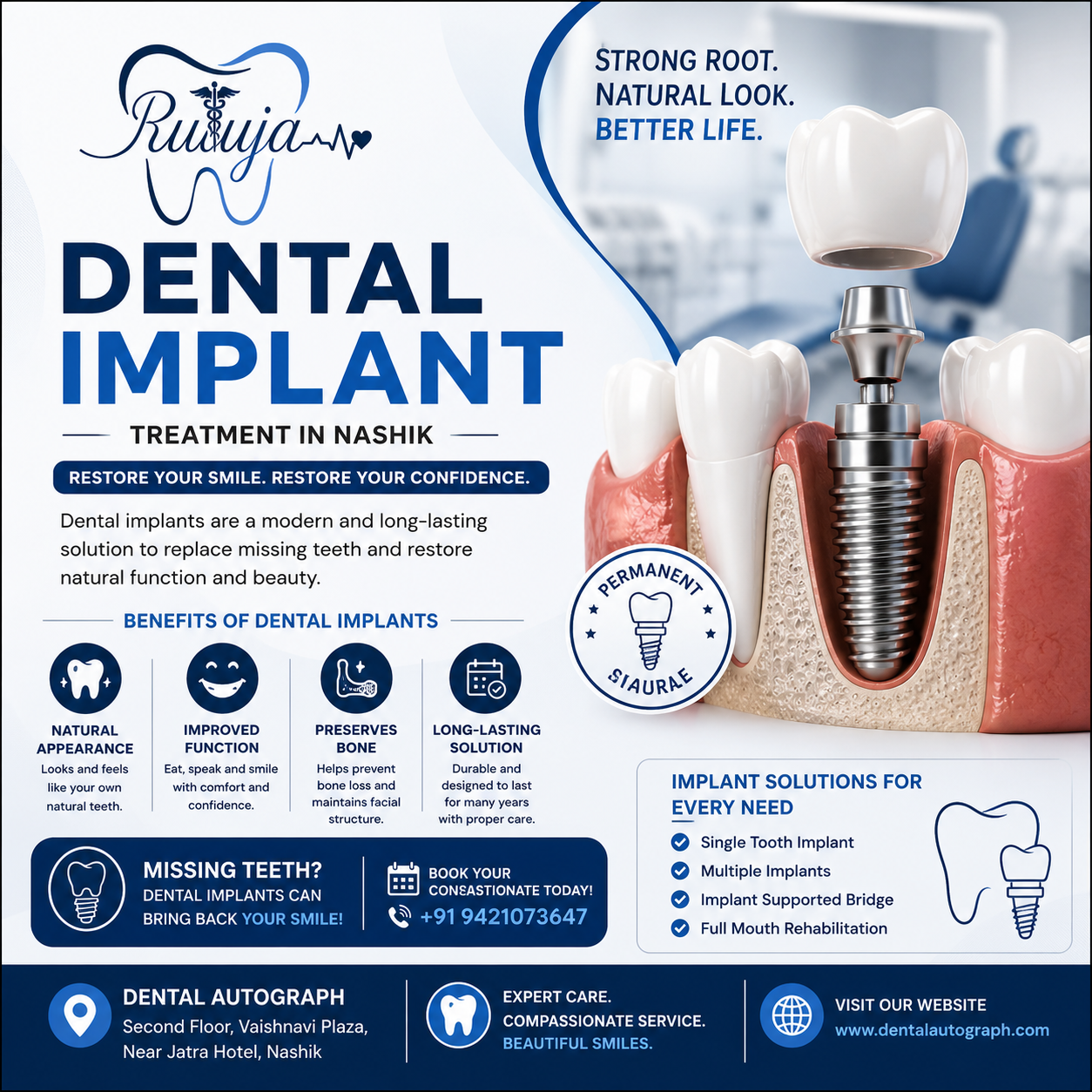 Dental Implant Treatment in Nashik – Restore Your Smile with Confidence