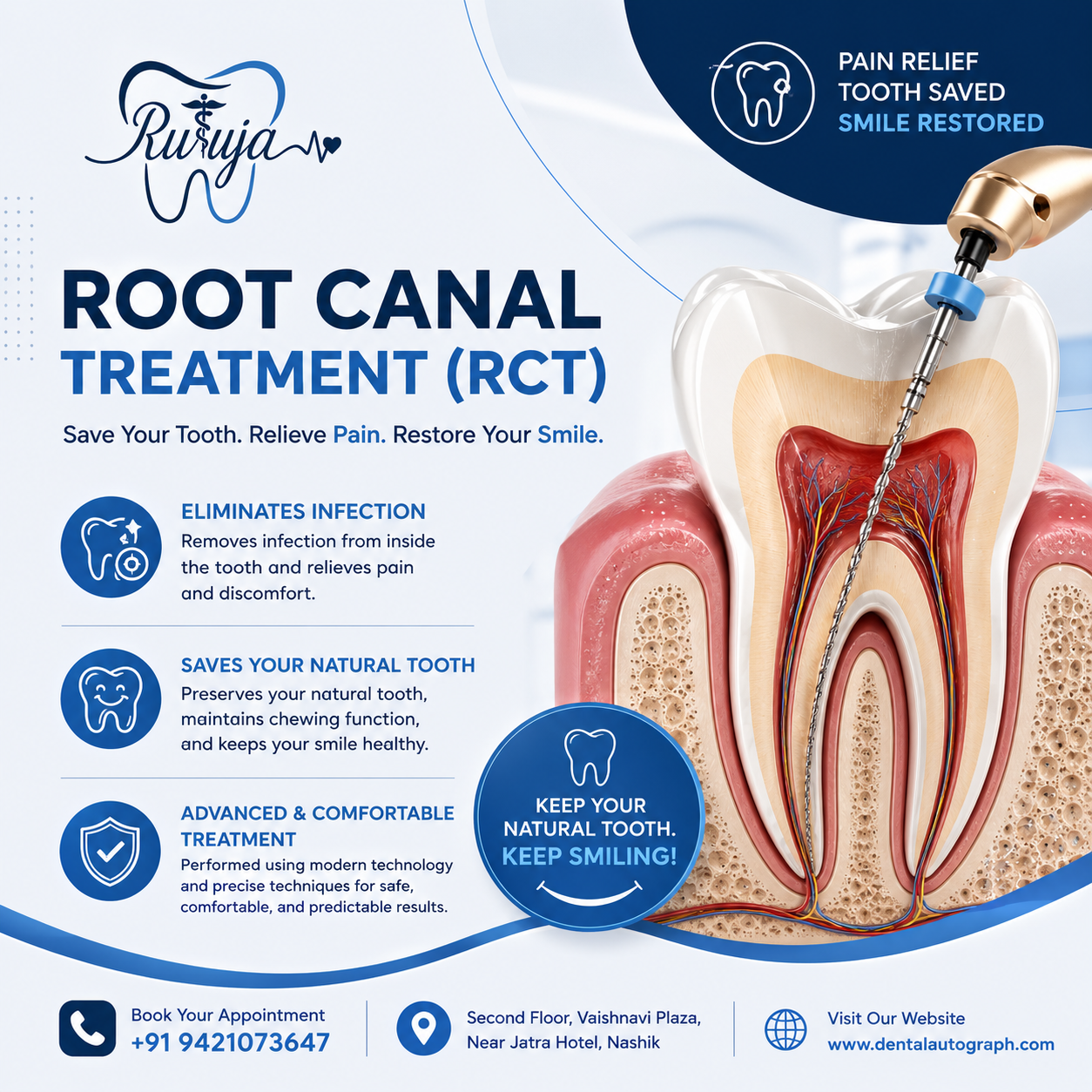 Root Canal Treatment Near Me in Nashik | Expert Endodontic Care Near Jatra Hotel