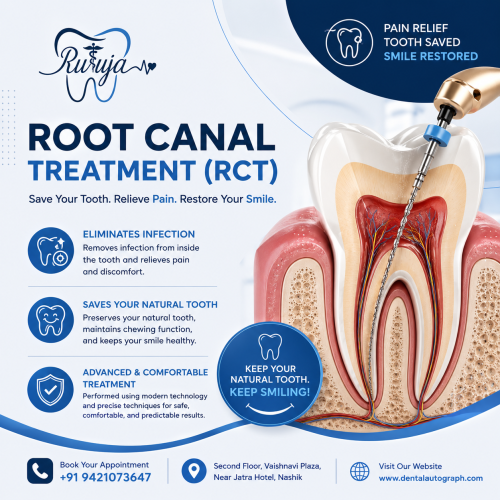 Root Canal Treatment Near Me in Nashik | Expert Endodontic Care Near Jatra Hotel