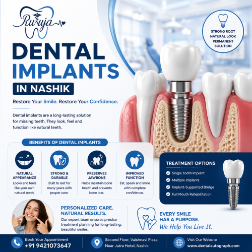Dental Implants in Nashik | Dental Autograph