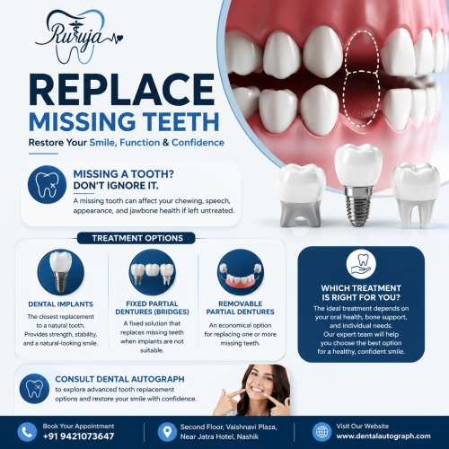 Replace Missing Teeth: Restore Your Smile, Function & Confidence