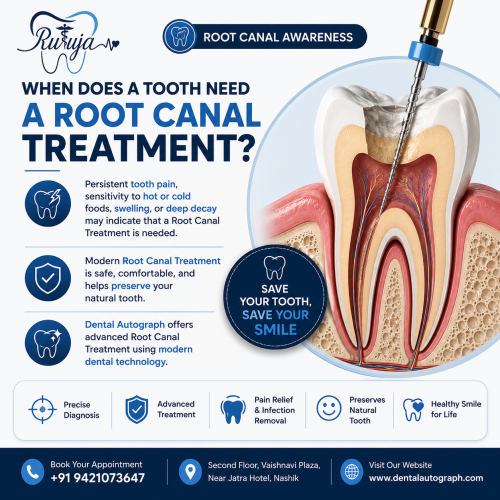 When Does a Tooth Need a Root Canal Treatment?